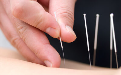 Precision and Balance: How PriceGuide Can Transform Your Acupuncture Services Business